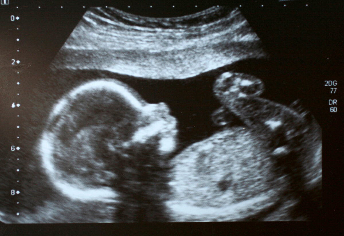 Perfil Biofísico Fetal